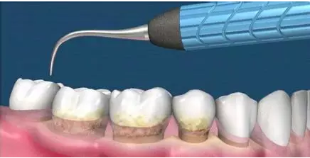 QQ圖片20150710171744.png QQ圖片20150710171744.png