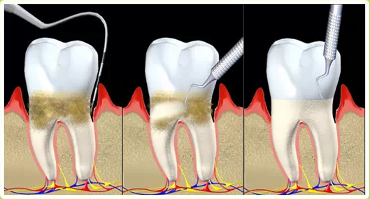 QQ圖片20150710171838.png QQ圖片20150710171838.png