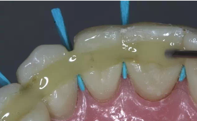 QQ圖片20150710171933.png QQ圖片20150710171933.png