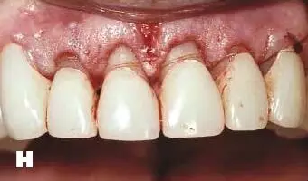 QQ圖片20150710172023.png QQ圖片20150710172023.png