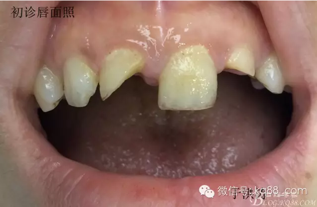 QQ圖片20150711104725.png QQ圖片20150711104725.png