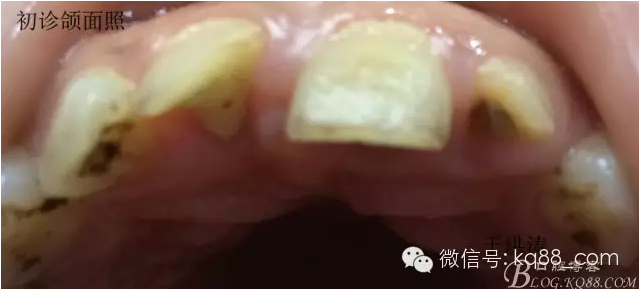 QQ圖片20150711104748.png QQ圖片20150711104748.png