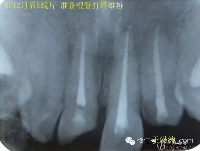 QQ圖片20150711105059.png QQ圖片20150711105059.png