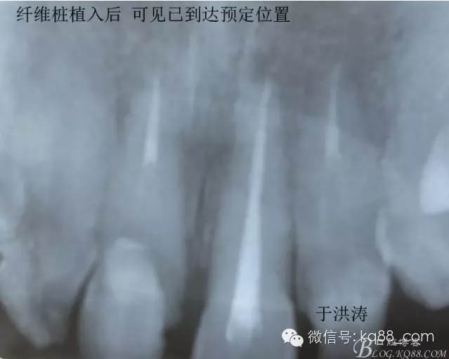 QQ圖片20150711105259.png QQ圖片20150711105259.png