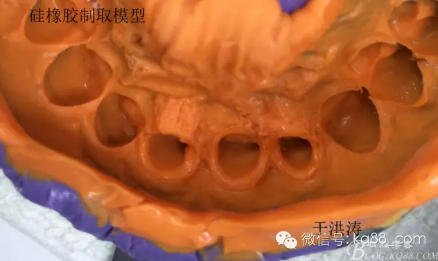 QQ圖片20150711105342.png QQ圖片20150711105342.png