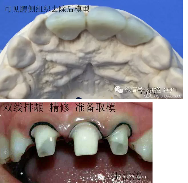 QQ圖片20150711105426.png QQ圖片20150711105426.png