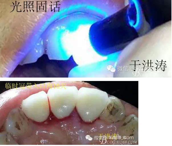 QQ圖片20150711105710.png QQ圖片20150711105710.png