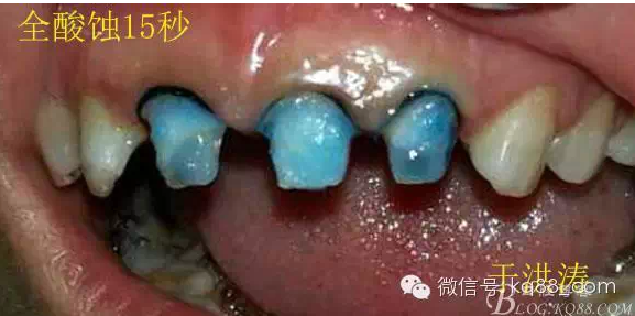 QQ圖片20150711105825.png QQ圖片20150711105825.png