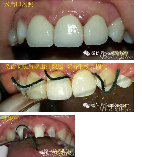 QQ圖片20150711105920.png QQ圖片20150711105920.png