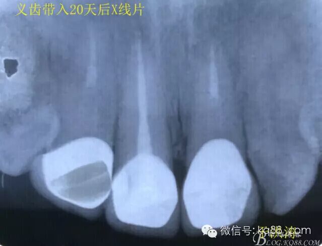 QQ圖片20150711110415.jpg QQ圖片20150711110415.jpg