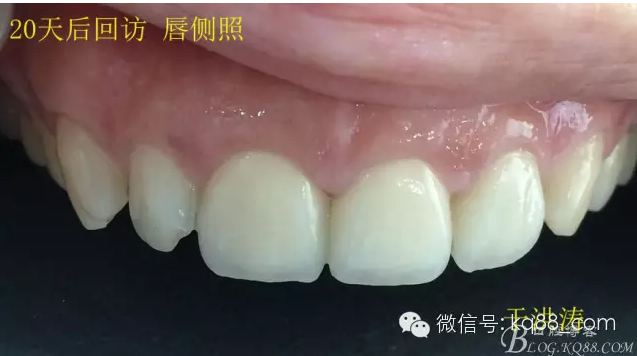 QQ圖片20150711110435.png QQ圖片20150711110435.png