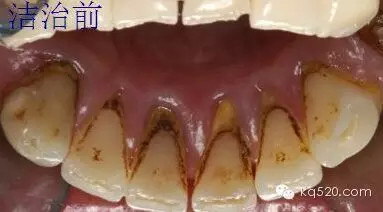 QQ圖片20150711133318.png QQ圖片20150711133318.png