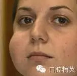 口腔局部麻醉并發(fā)癥及臨床處理 口腔局部麻醉并發(fā)癥及臨床處理