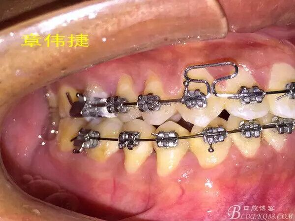 QQ圖片20150711162233.jpg QQ圖片20150711162233.jpg