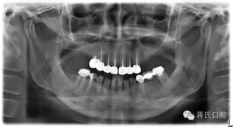 QQ圖片20150711174005.png QQ圖片20150711174005.png