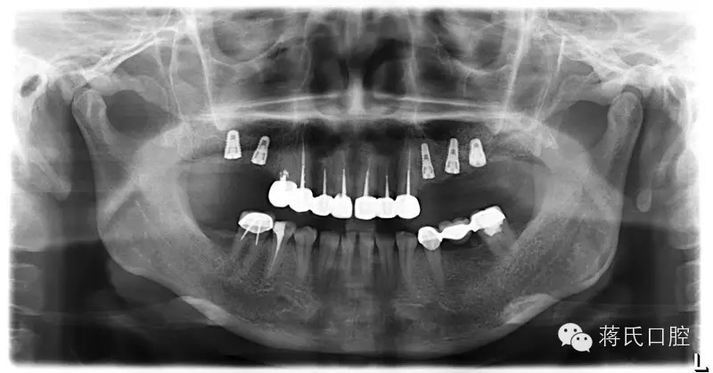 QQ圖片20150711174937.png QQ圖片20150711174937.png