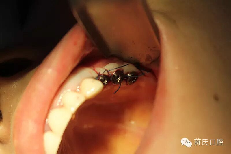 QQ圖片20150711175330.jpg QQ圖片20150711175330.jpg