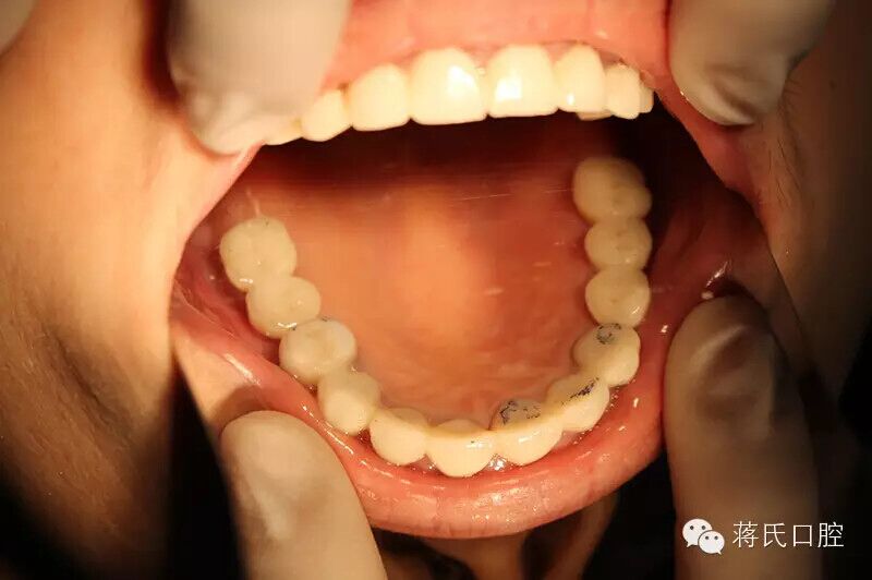 QQ圖片20150711175548.jpg QQ圖片20150711175548.jpg