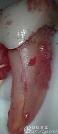 QQ圖片20150712103642.png QQ圖片20150712103642.png