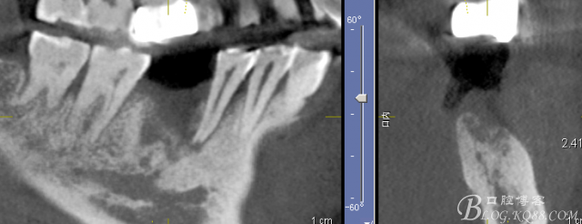 QQ圖片20150712103833.png QQ圖片20150712103833.png