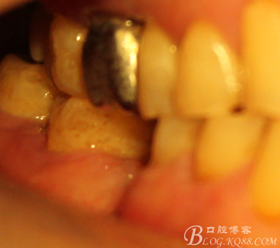 QQ圖片20150712103914.png QQ圖片20150712103914.png