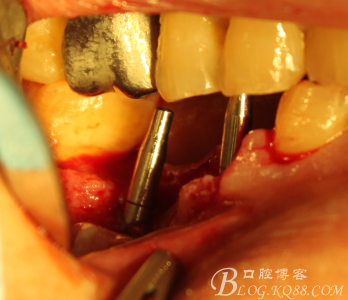 QQ圖片20150712104039.png QQ圖片20150712104039.png