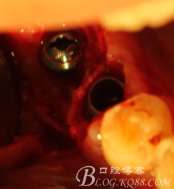 QQ圖片20150712104158.png QQ圖片20150712104158.png