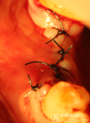 QQ圖片20150712104333.png QQ圖片20150712104333.png