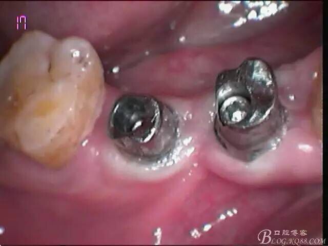 QQ圖片20150712110518.jpg QQ圖片20150712110518.jpg