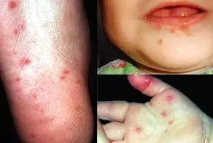 QQ圖片20150712141637.png QQ圖片20150712141637.png