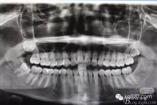 QQ圖片20150712143204.jpg QQ圖片20150712143204.jpg