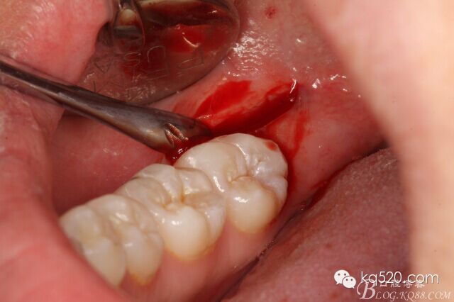 QQ圖片20150712143354.jpg QQ圖片20150712143354.jpg