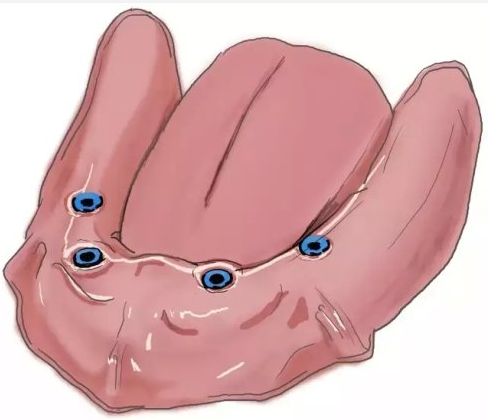 種植【最全的種植牙介紹】 種植【最全的種植牙介紹】