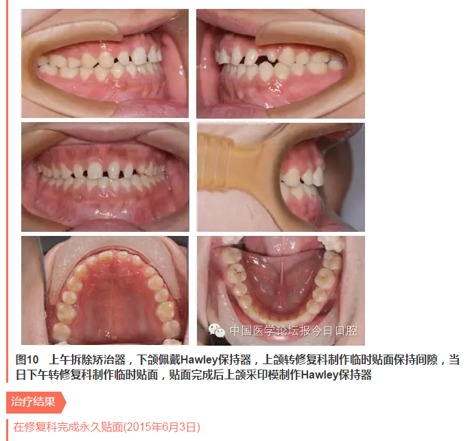 QQ圖片20150714135639.png QQ圖片20150714135639.png