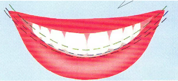 QQ圖片20150717111025.png QQ圖片20150717111025.png