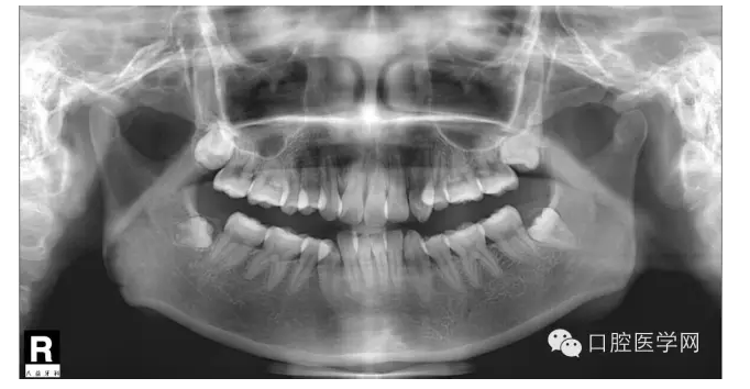 QQ圖片20150717171212.png QQ圖片20150717171212.png