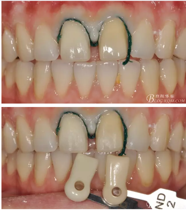 QQ圖片20150718114257.png QQ圖片20150718114257.png