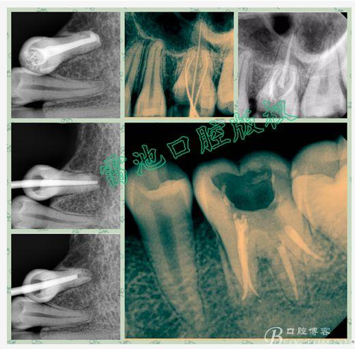 QQ圖片20150720104215.png QQ圖片20150720104215.png