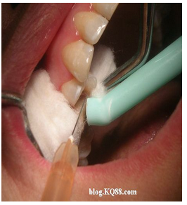 QQ圖片20150720134740.png QQ圖片20150720134740.png