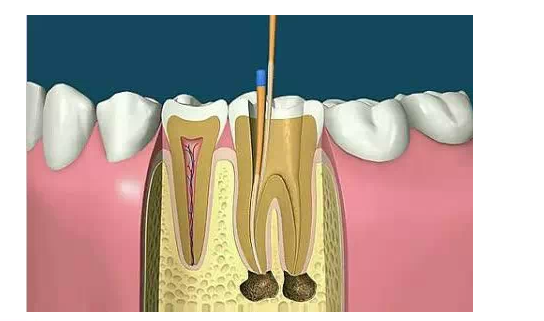QQ圖片20150720142725.png QQ圖片20150720142725.png