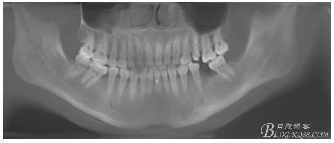 QQ圖片20150721091349.png QQ圖片20150721091349.png