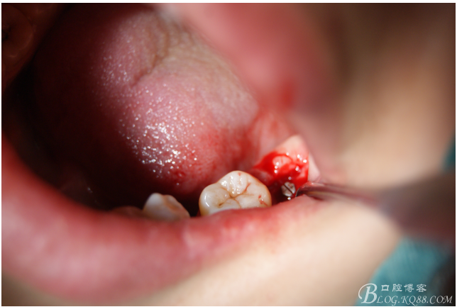 QQ圖片20150721091504.png QQ圖片20150721091504.png