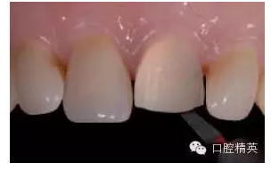 QQ圖片20150721093306.png QQ圖片20150721093306.png