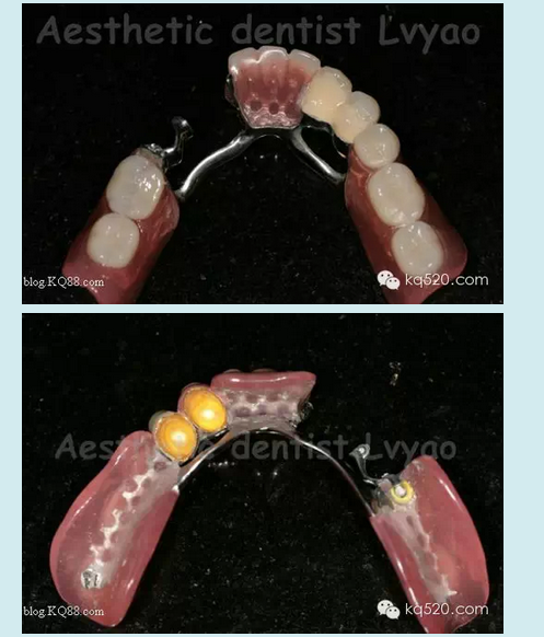 QQ圖片20150721152519.png QQ圖片20150721152519.png