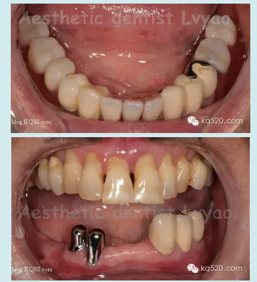 QQ圖片20150721152446.png QQ圖片20150721152446.png