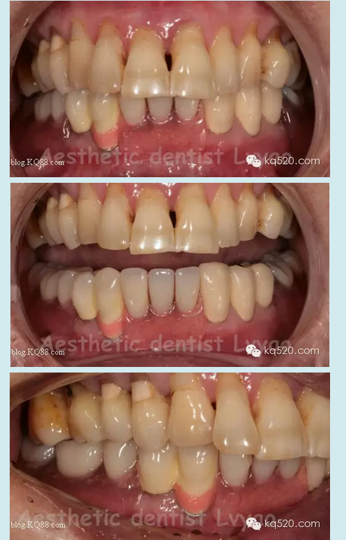 QQ圖片20150721152429.png QQ圖片20150721152429.png