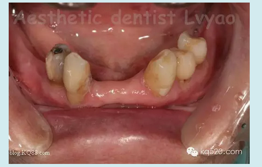 QQ圖片20150721152403.png QQ圖片20150721152403.png