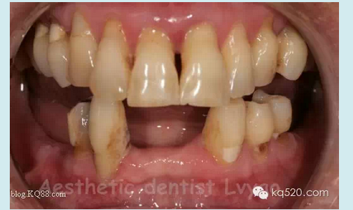 QQ圖片20150721152336.png QQ圖片20150721152336.png