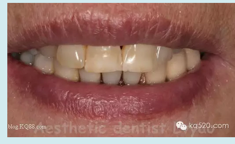 QQ圖片20150721152314.png QQ圖片20150721152314.png