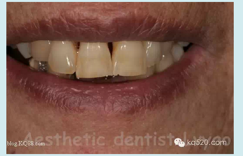 QQ圖片20150721152257.png QQ圖片20150721152257.png